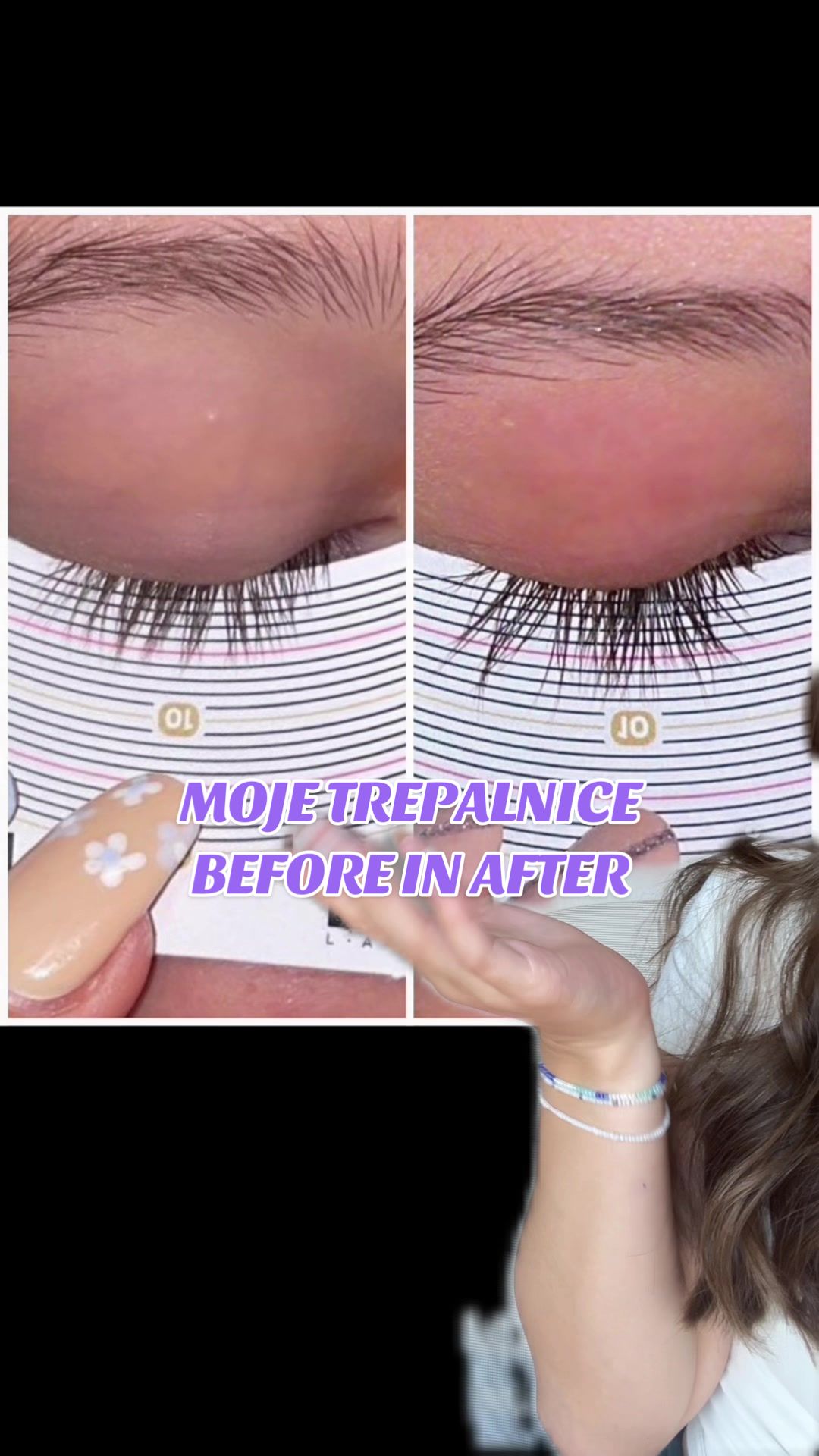 TikTok post by @tiaembersic for Active Luxe Cosmetics. Caption reads: [...] Moje trepalnice before in after! @Active....