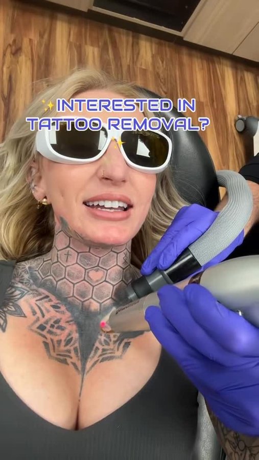 Instagram post by @carissa.did.it for Removery. Caption reads: I still have a few more sessions with @removery ,....