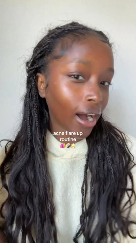 Instagram post by @ivy4eva for Clinique. Caption reads: [...] it worse. I’ve been reaching for the....
