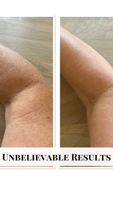 Instagram post by @themichellespieler for OneSkin. Caption reads: Never a better time to try or replenish....