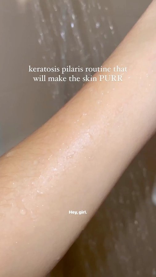 Instagram post by @belicia.arnold for Frank Body. Caption reads: nah cause the body care is badly neglected....