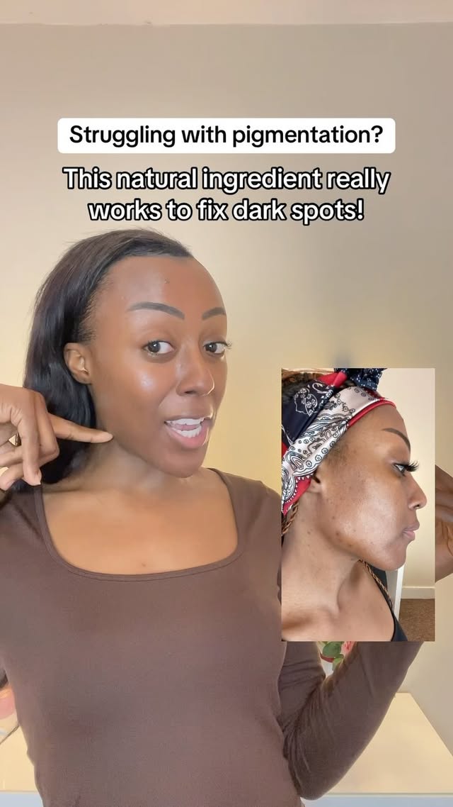 Instagram post by @skincarebysare for Balance Me Natural Skincare. Caption reads: Brighten up your skin with the power of Azelaic....