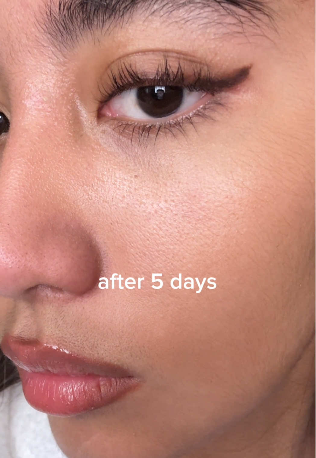 TikTok post by @camilajtorres for Dr.G. Caption reads: @Dr. G my skin thankss you #PR #drg #redblemish....