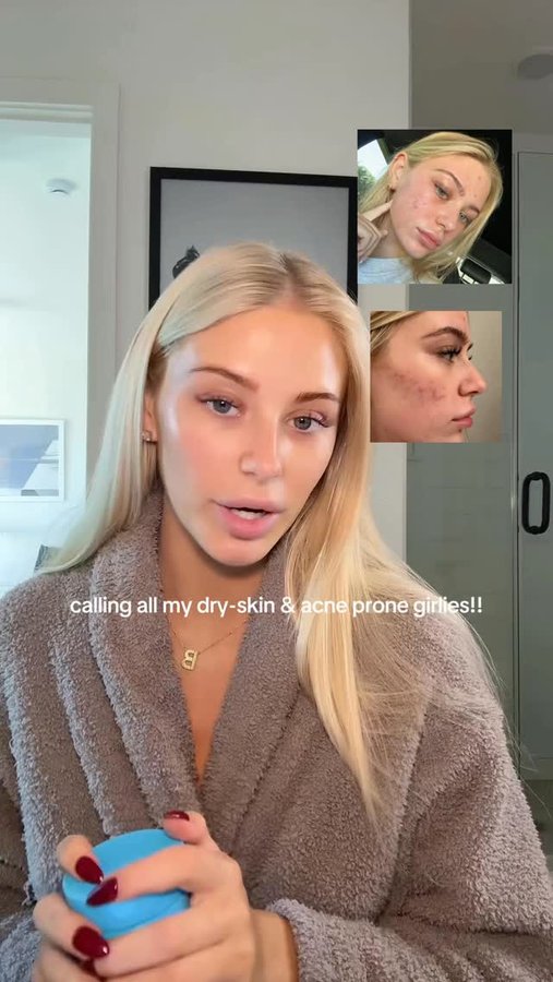 Instagram post by @ladycarolinewiley for Skinfix. Caption reads: #ad my secret to keeping my skin suuuper hydrated....