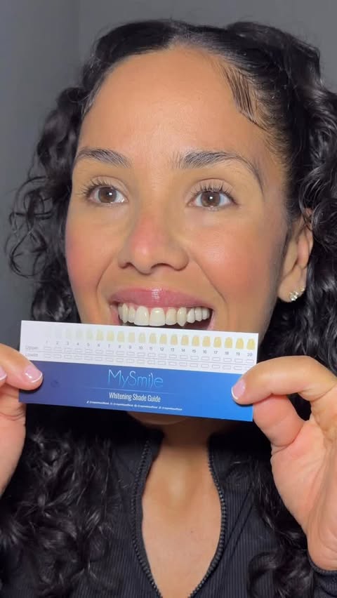 Instagram post by @withchristina21 for MySmile. Caption reads: [...] me what I whiten with HERE YA GO! @mysmile....
