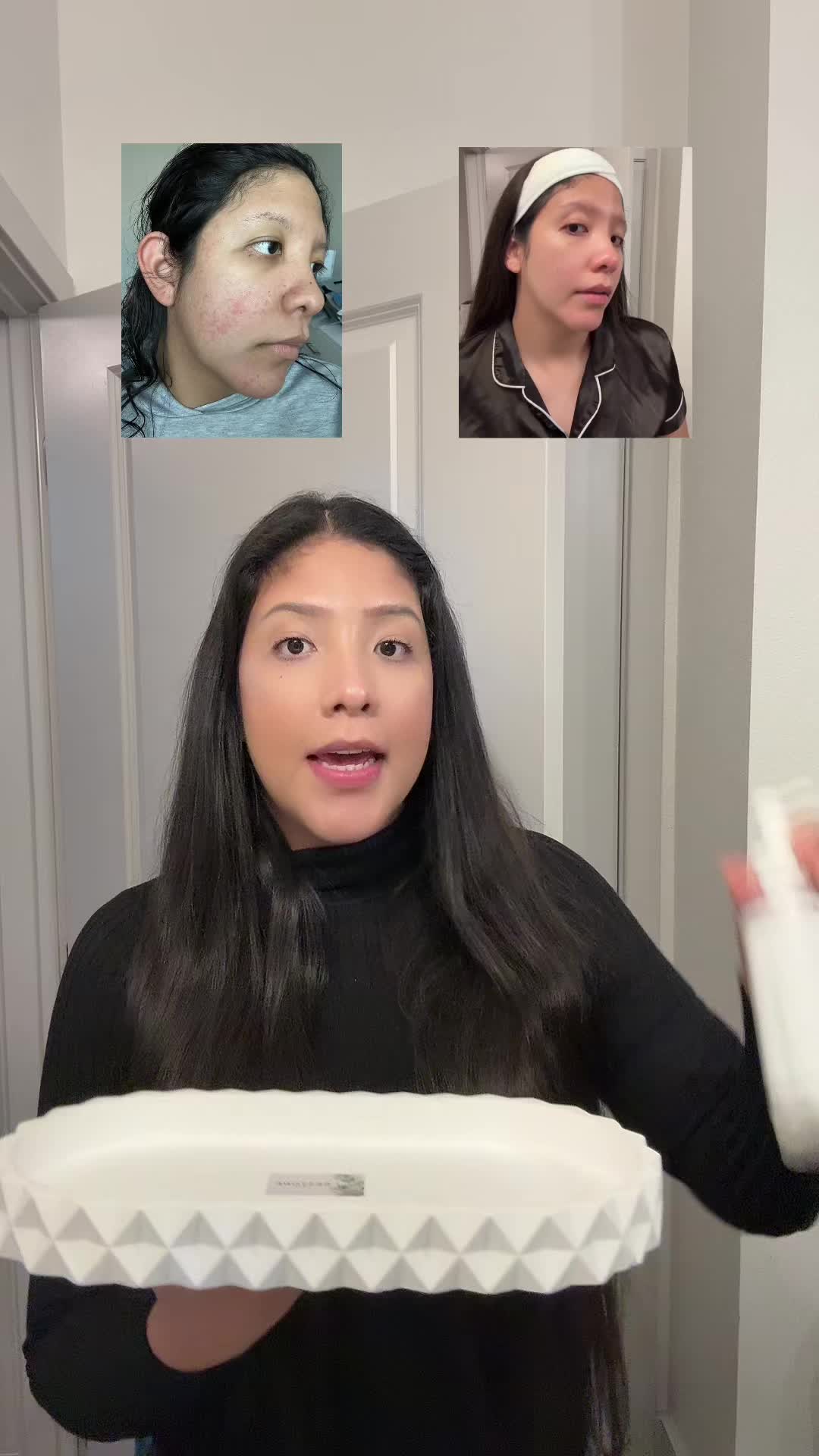 TikTok post by @anii.fflores for Anua. Caption reads: [...] mi piel está más sana y sin acné ✨ #Anua....