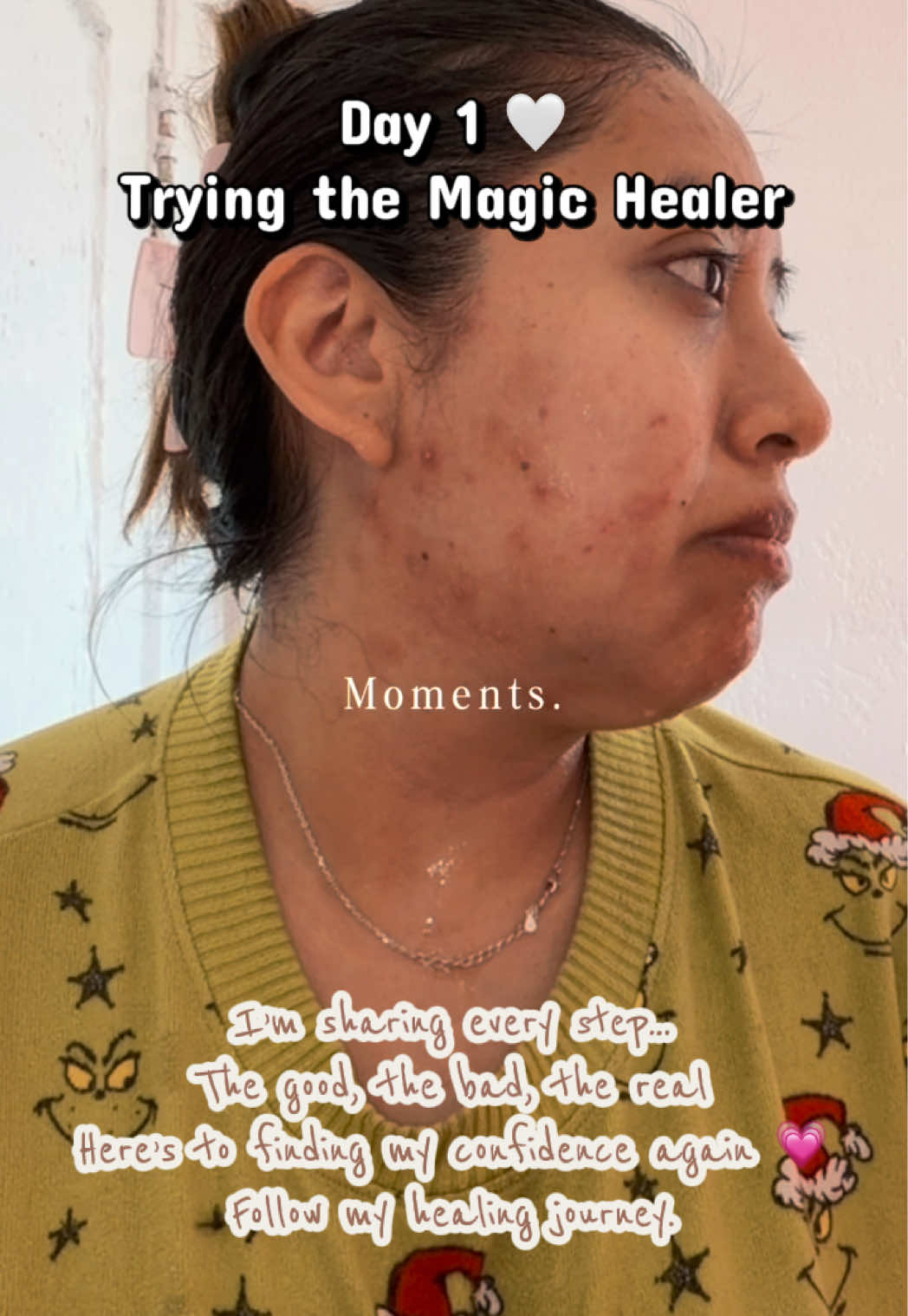 TikTok post by @esthelah27 for MyMagicHealer. Caption reads: [...] This is my first time trying....