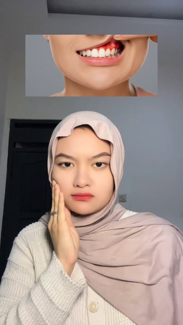 Instagram post by @nsfwtn for Tanya Pepsodent. Caption reads: Kadang kita baru sadar pentingnya gusi pas udah....