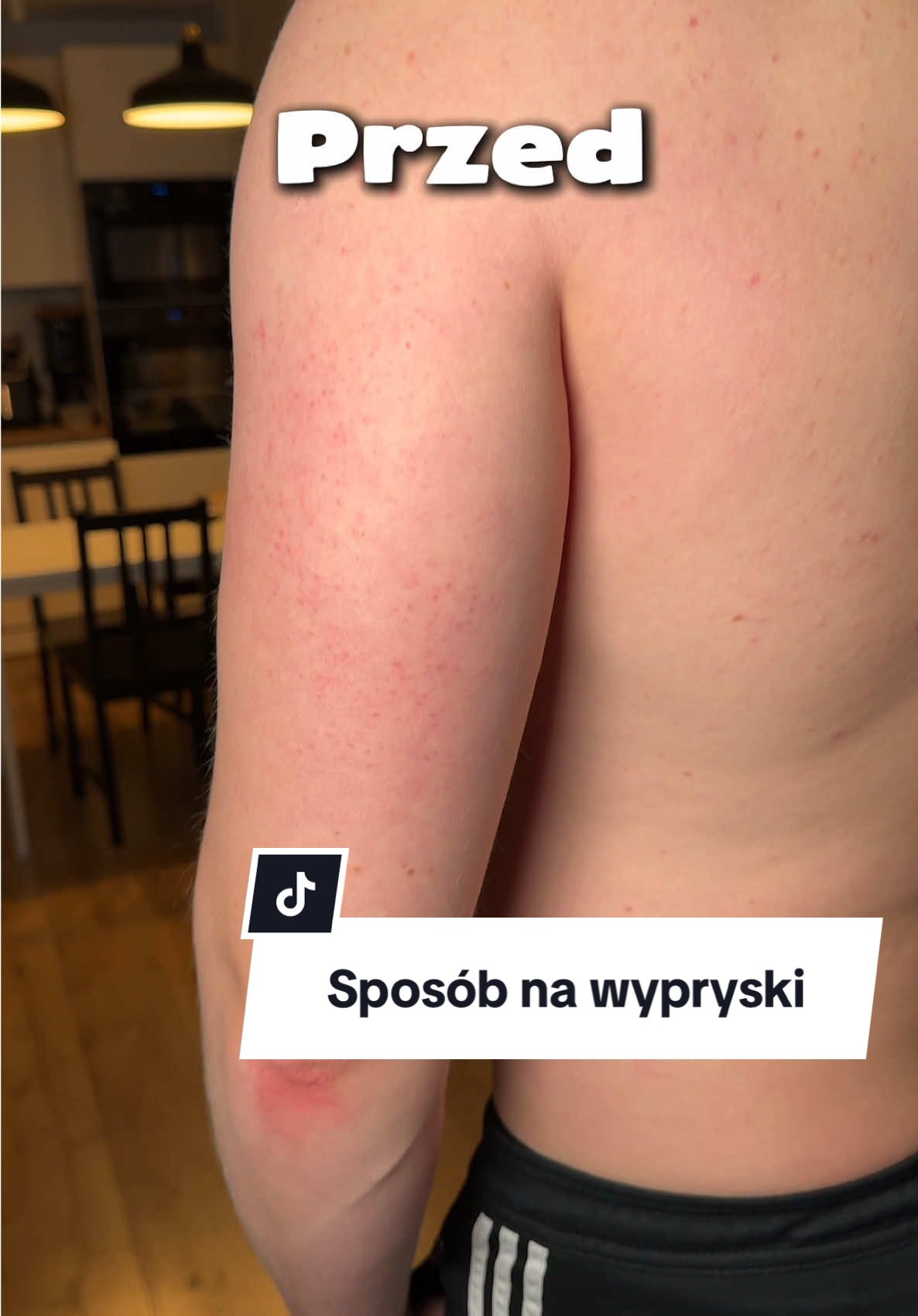 TikTok post by @patitv_pl for Cosibella. Caption reads: [...] skórę po goleniu 🤩♥️ cudo od SkinTra....