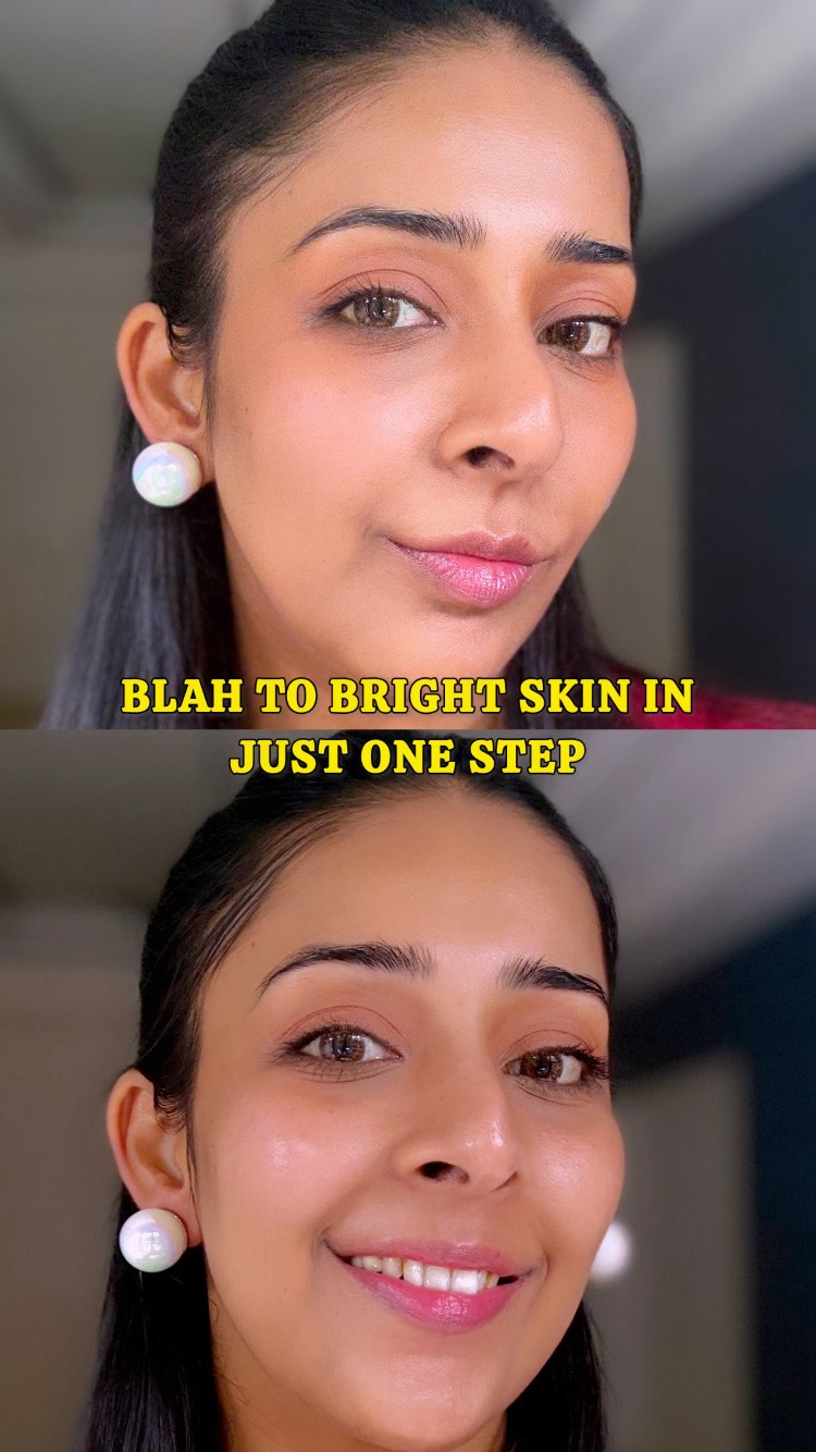 Instagram post by @shruti_jain_official for Ozone Ayurvedics. Caption reads: Apparently, my face has been collecting souvenirs....