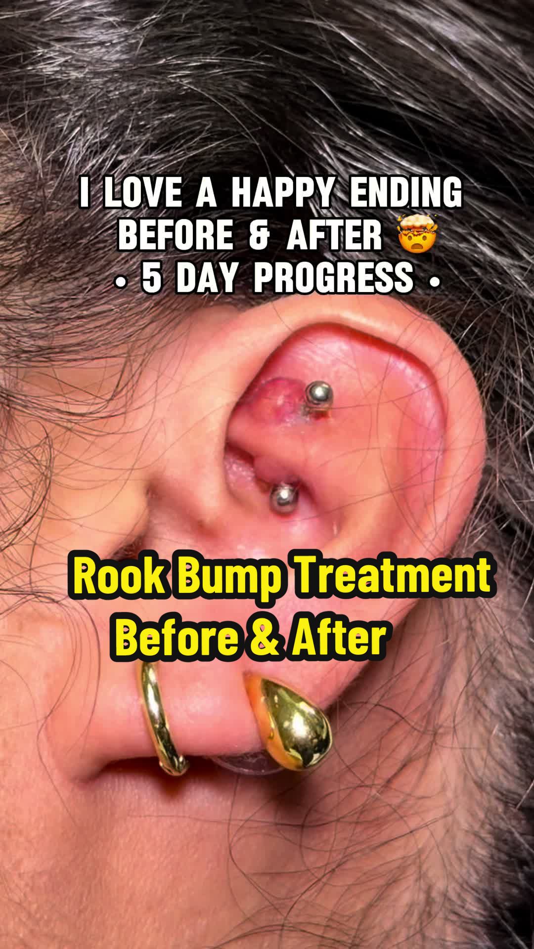 TikTok post by @anamarpiercing for Base Laboratories. Caption reads: [...] progressed 👌🙂‍↔️ aftercare by @Base....