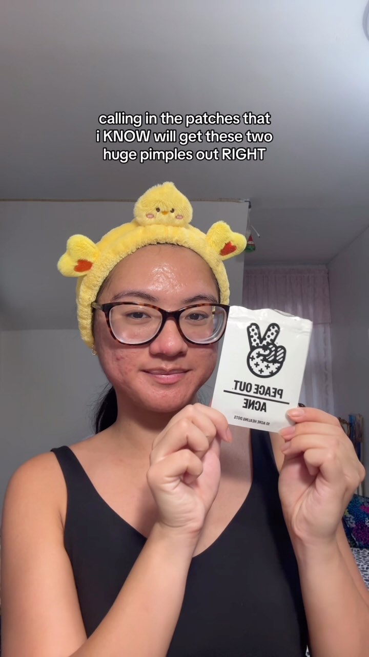 Instagram post by @thatacnegirlie for Peace Out Skincare. Caption reads: nose pimples are the bane of my existence 😀

but....