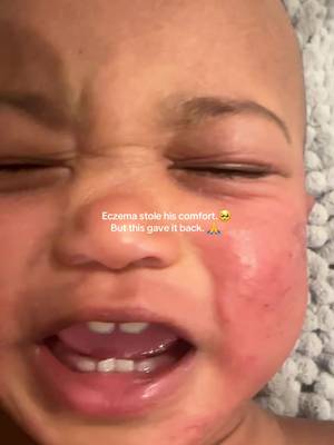 TikTok post by @carmonaclan for Healed By The Ocean. Caption reads: [...] #theoceanhealedmyeczema @Healed By The Ocean.
