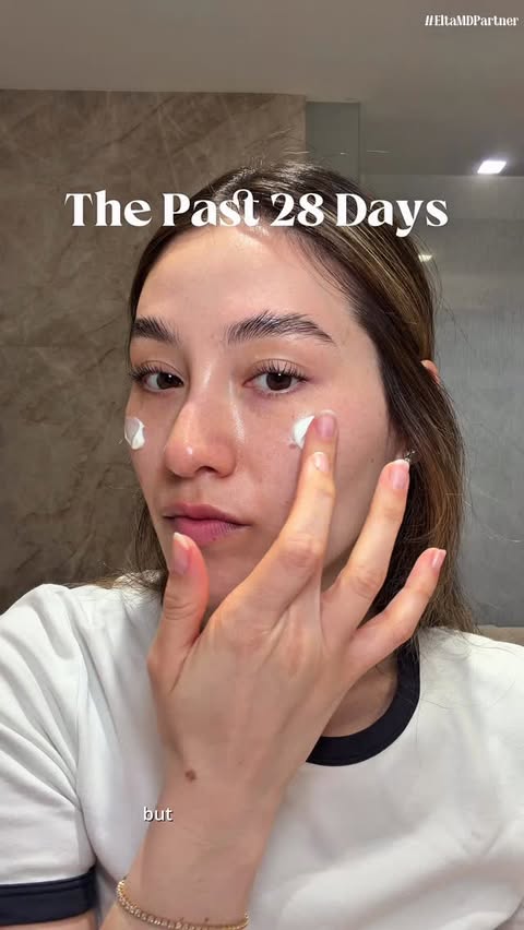 Instagram post by @barefacedfemme for EltaMD. Caption reads: [...] mistake, ugh. 28 days of using....