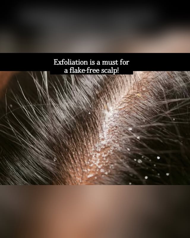 Instagram post by @poulami_ch_ for Biolage. Caption reads: [...] exfoliator. I’ve been loving the Biolage....