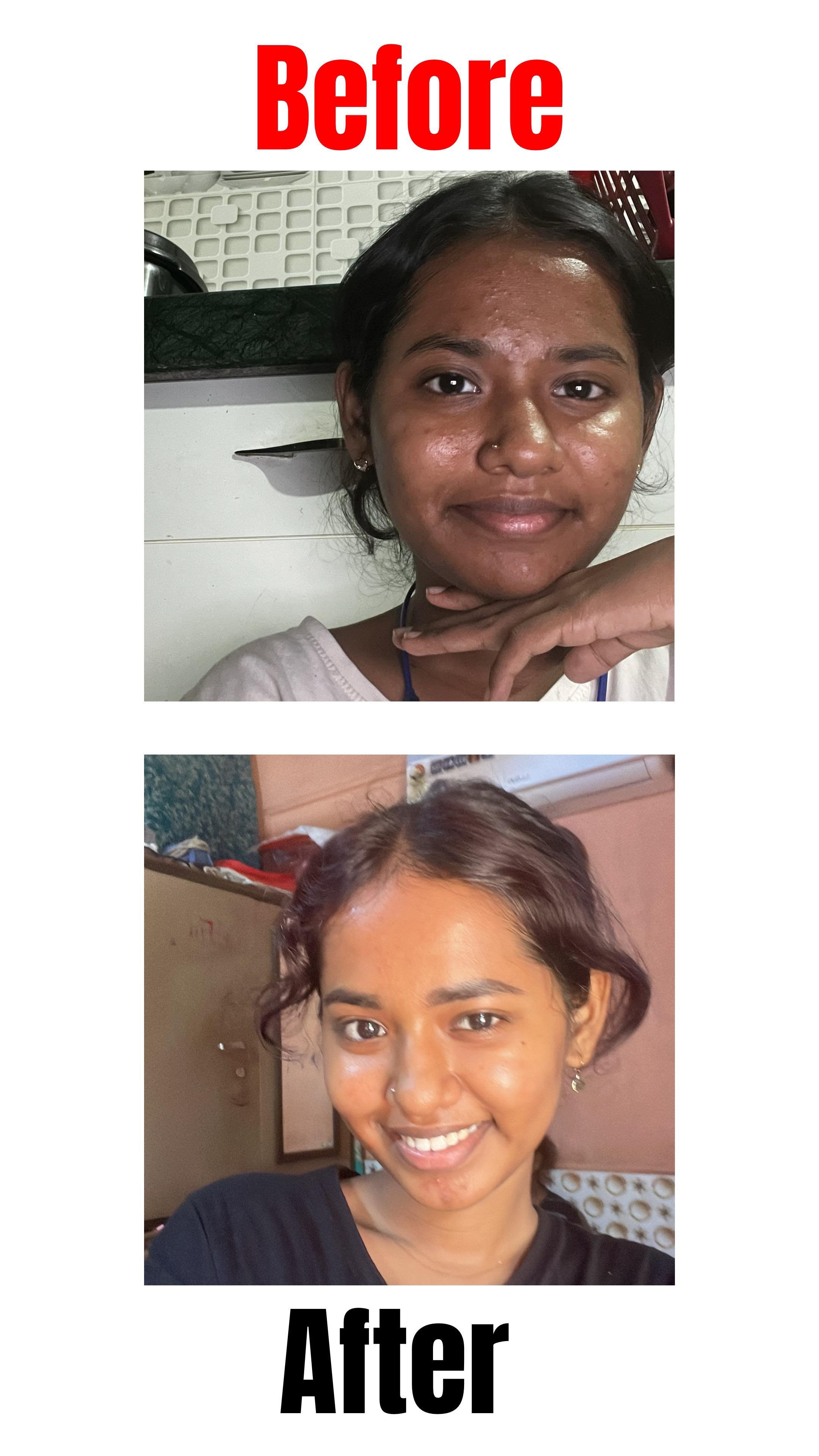 Instagram post by @shrutcyy for Reequil. Caption reads: I’m obsessed with Re’equil’s 0.1% Retinol Night....