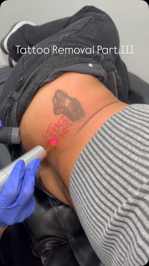 Instagram post by @namedafterahat for Removery. Caption reads: [...] the pain discourage you — it will all be....