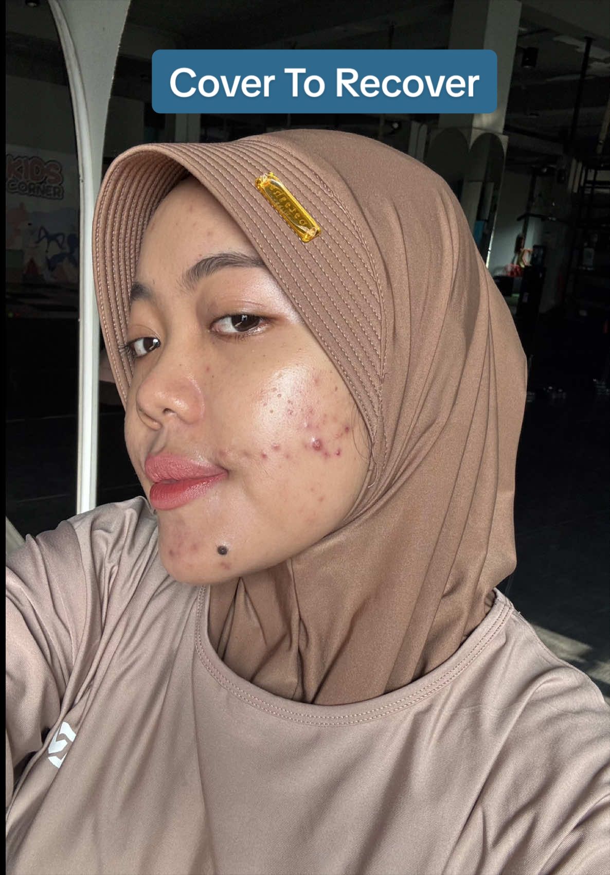 TikTok post by @anisaaryant for Nurilab.id. Caption reads: [...] punya kulit berjerawat kayak aku @Nurilab.id....