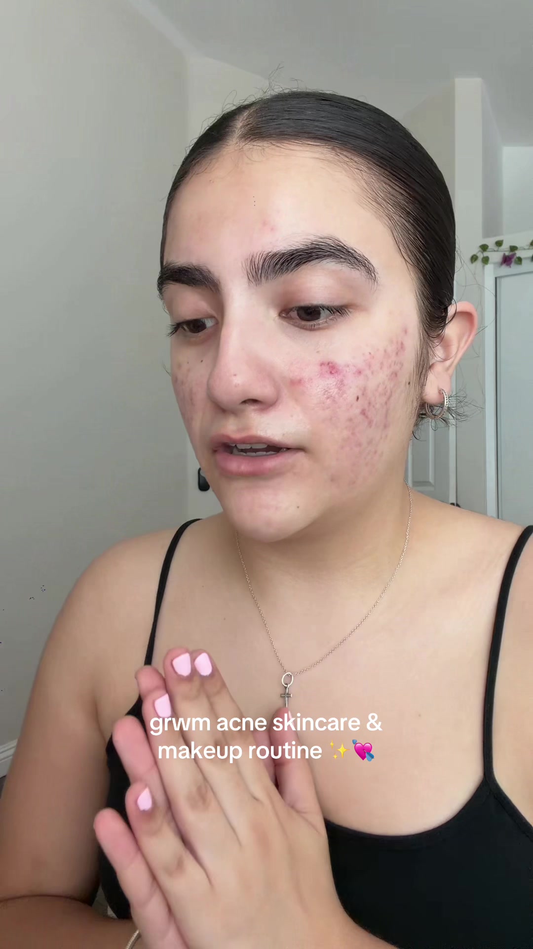 TikTok post by @ashleysspam20 for IUNIK. Caption reads: products: @anua_global azelaic acid @IUNIK Beta....
