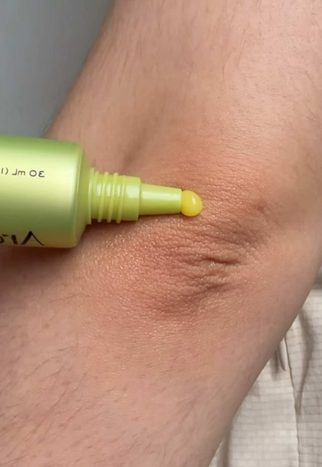 TikTok post by @cco.cla for arencia. Caption reads: Getting rid of the dark elbow with this Arencia's....