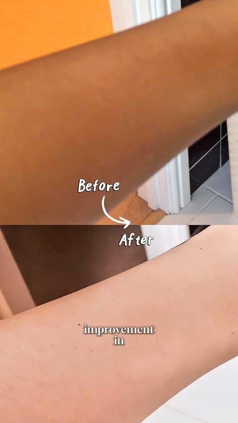 Instagram post by @mansii_jn for Be Bodywise. Caption reads: [...] + BHA = my body-care upgrade ✨🫧 The Be....