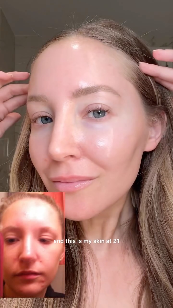 Instagram post by an influencer for ANUA Global. Caption reads: Why we’re switching to double cleansing ✨ using....