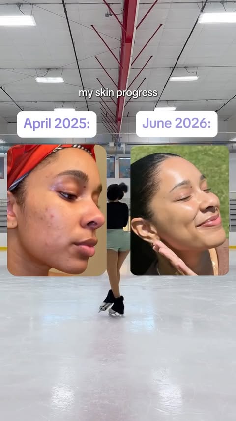 Instagram post by @sophia.lazuli for Curology. Caption reads: #CurologyPartner I knew my skin was improving,....