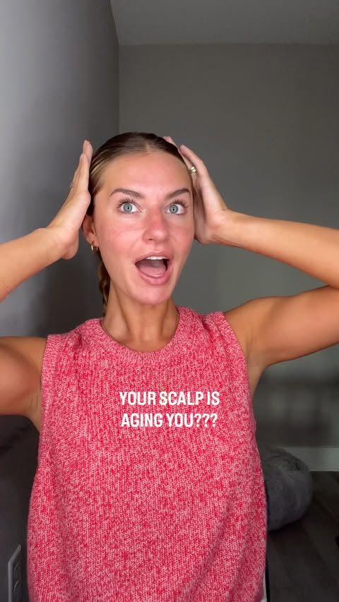 Instagram post by @goesbymeg for Lilyeve. Caption reads: Is your scalp the culprit? 👀 #LilyevePartner....