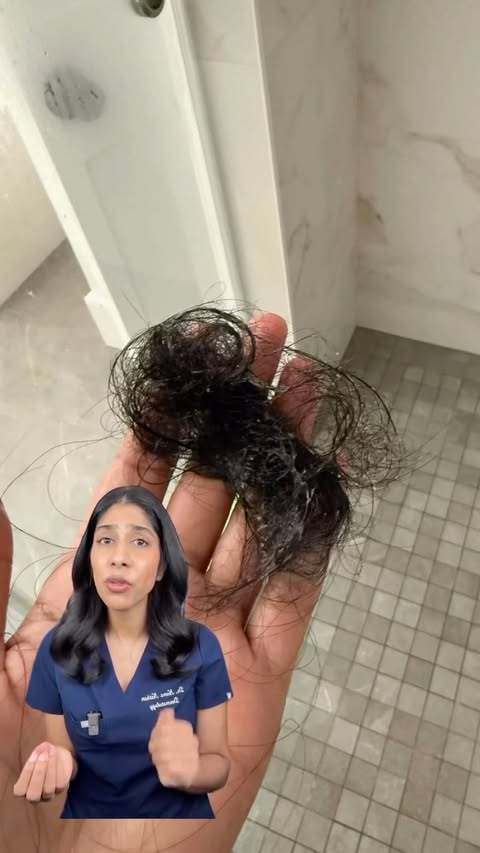 Instagram post by @dermatologysurgeon for VEGAMOUR. Caption reads: Experiencing significant shedding? The @vegamour....