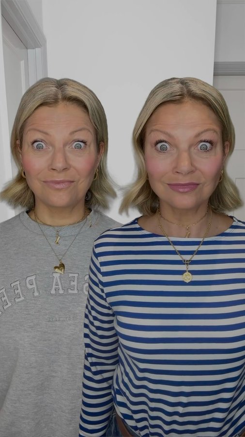 Instagram post by an influencer for Vanity Lab London. Caption reads: [...] fresher ❤️💉💋 Thank you @vanitylablondon ❤️....