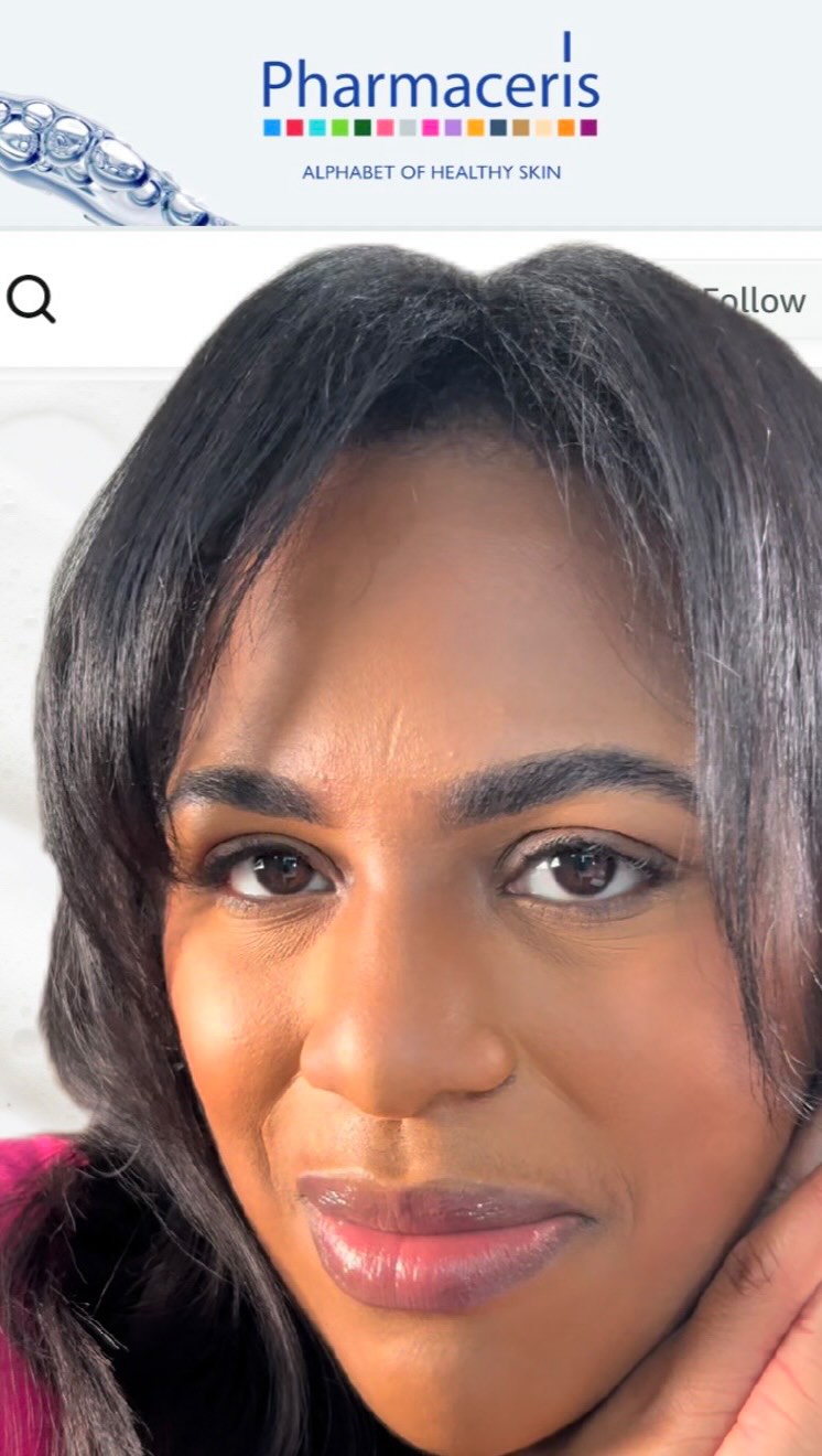 Instagram post by @theemmaelyse for Pharmaceris. Caption reads: I love being able to help my oily and acne-prone....