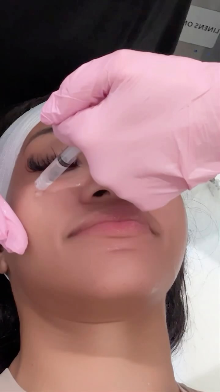 Instagram post by @brittneyenora for LaserAway. Caption reads: You put WHAT on your face? 👀 Sounds weird, but....