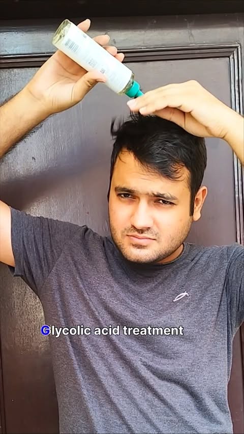 Instagram post by @gauravghangas_gg for Biolage. Caption reads: [...] scalp exfoliation in my routine. The Biolage....