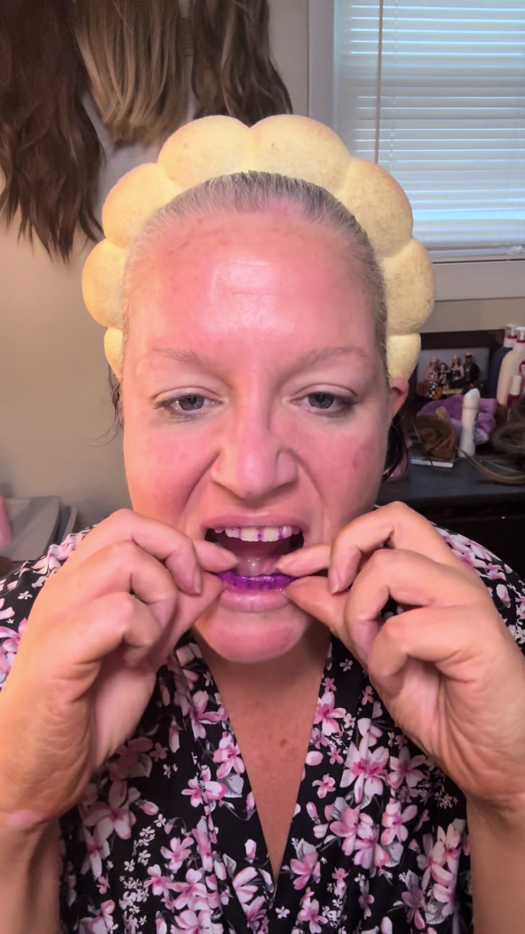 TikTok post by @kimberligray79 for LitBear. Caption reads: @LitBear strips for the win! #yellowteeth [...].