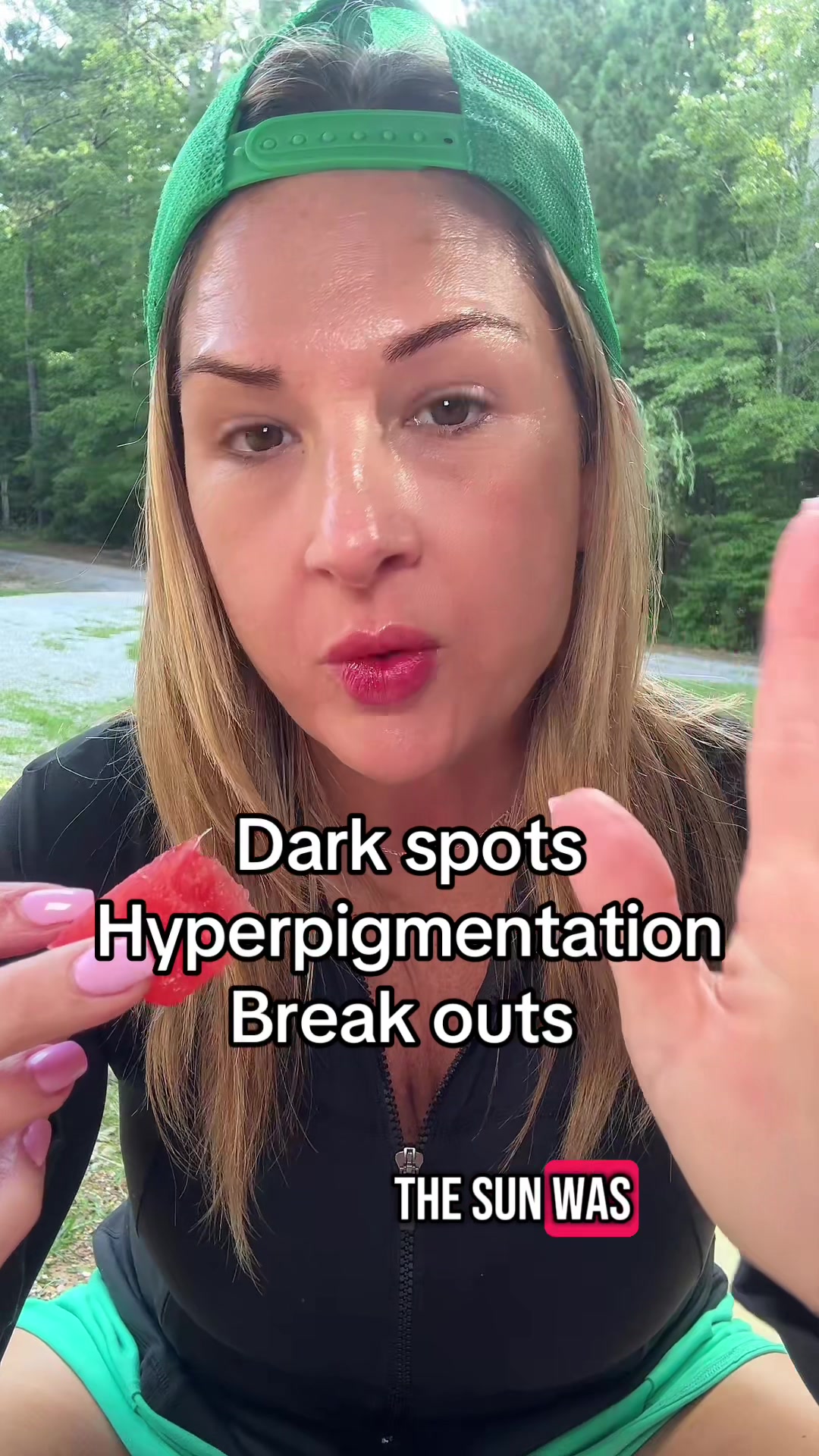TikTok post by @lotuswellness8 for Akasha Superfoods. Caption reads: Having the worst hyperpigmentation to where I am....
