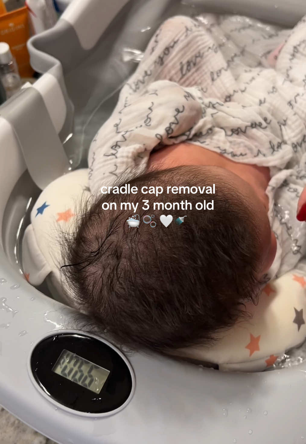 TikTok post by @vivianaaivette for Tubby Todd. Caption reads: [...] scalps clean 🤍 Cradle cap gel: @Tubby Todd....