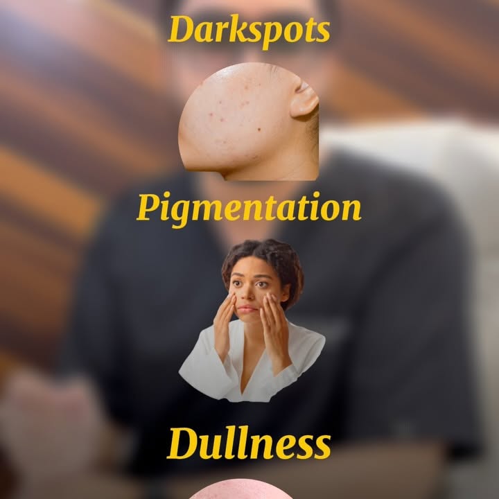Instagram post by @skindoctor4you for HK Vitals. Caption reads: Tired of pigmentation, dullness & dark spots in....