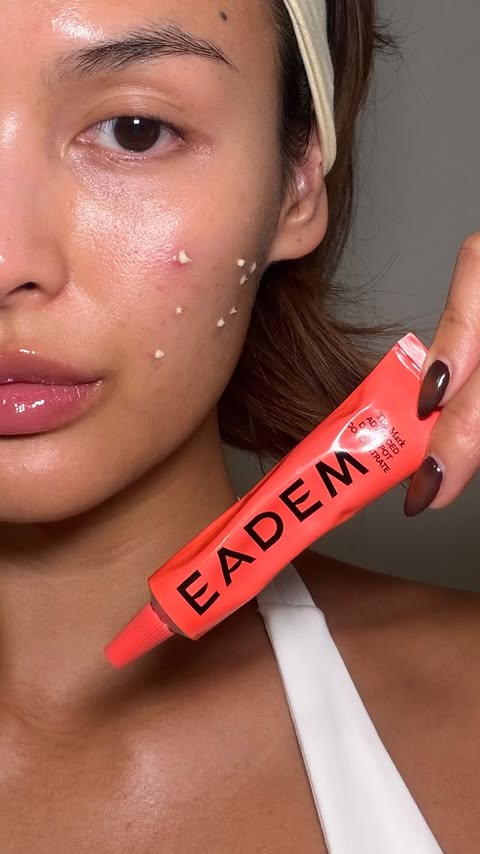 Instagram post by @adisalice for Eadem. Caption reads: [...] marks or dark spots… this is your sign✨....