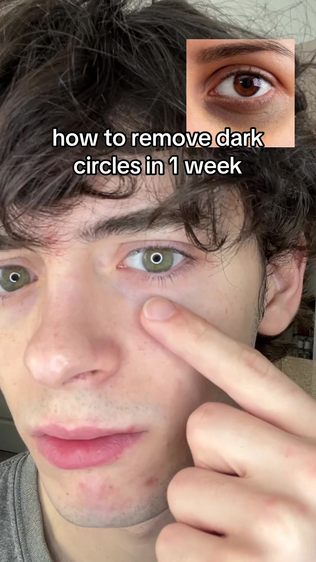 TikTok post by @ethentrips for Based BodyWorks. Caption reads: remove your dark eye circles @BASED #GlowUp #eyes....