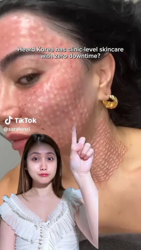 Instagram post by @trixjoyalcanar for Abib Cosmetics. Caption reads: Clinic Glow? Just Filler Cream 💉✨ @abib.global....