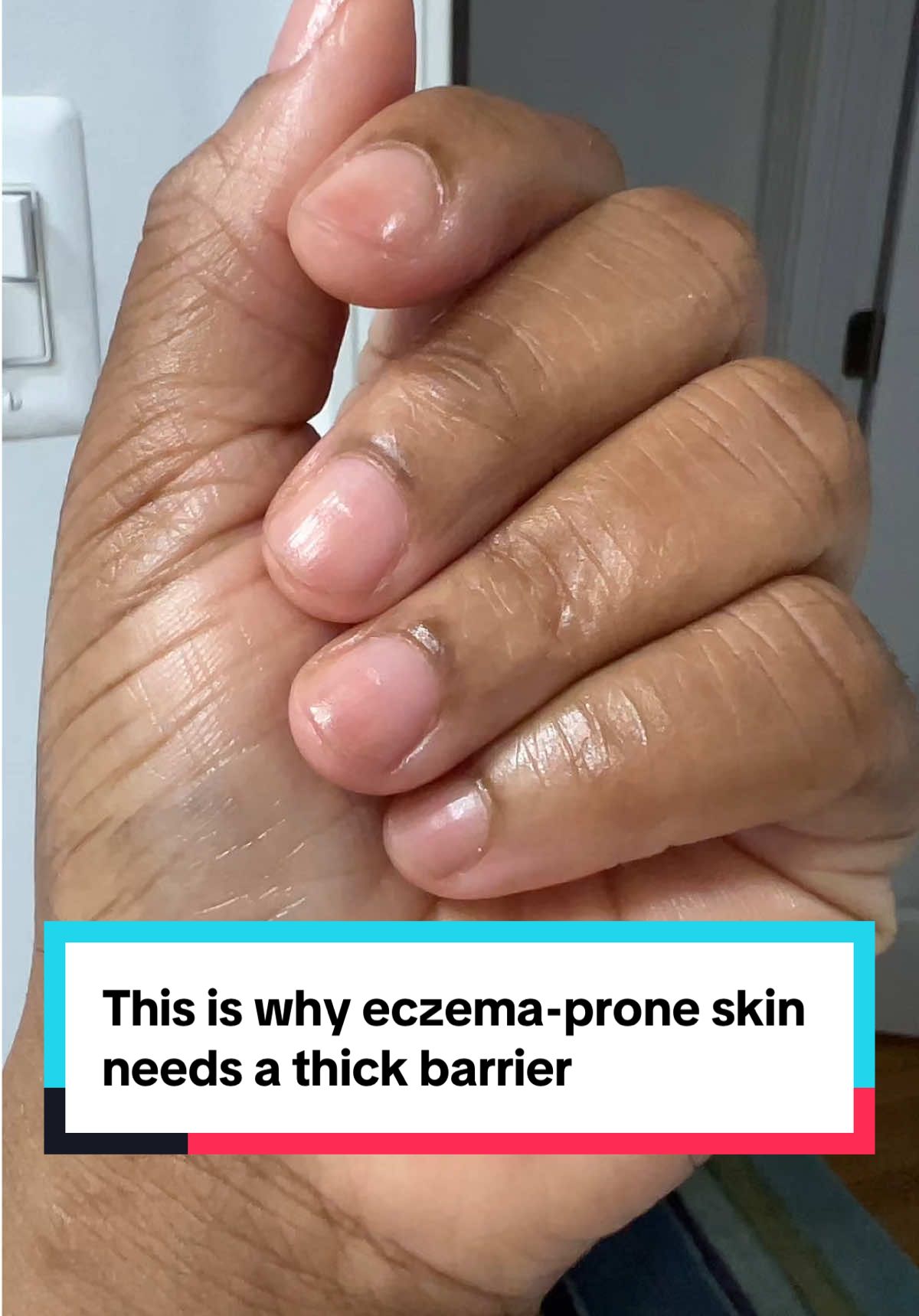 TikTok post by @msweeziebaby for Prequel Skin. Caption reads: [...] where it needs it most. @Prequelskin....