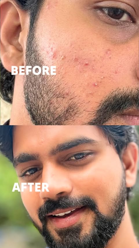 Instagram post by @vijaychowhann for Chemist at Play. Caption reads: [...] #mensfacewash #clearskin #glow....