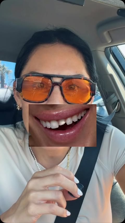 Instagram post by @adri_monteblay for Lumineux by Oral Essentials. Caption reads: Who remembers my little tooth mishap? 🫣😭 Well I....
