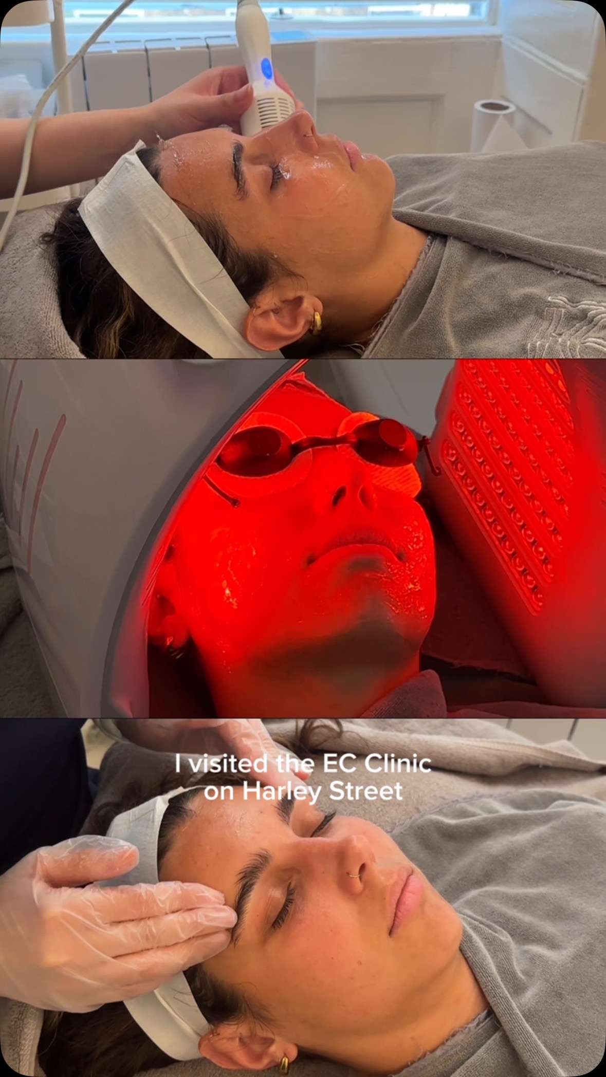 Instagram post by @evies__world_ for EC Clinic London. Caption reads: [...] Facial ✨

I visited the incredible....