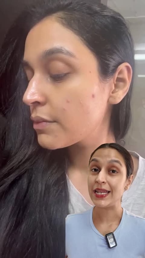 Instagram post by @chetalichadha for Novology. Caption reads: [...] get it in DM! 

• Key Features of the....