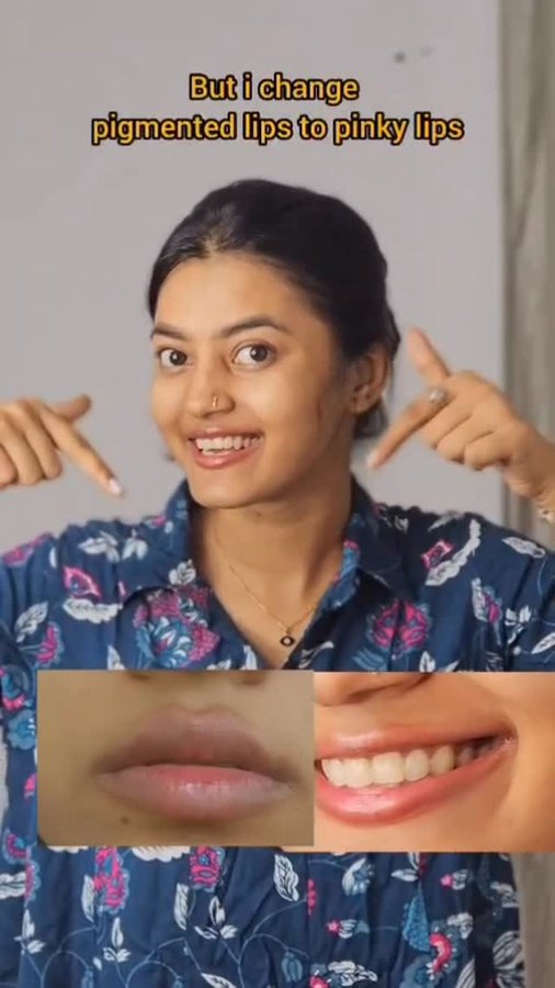 Instagram post by @th_e_arunima_ for WishCare. Caption reads: Comment for the link ❤️
Say bye bye to pigmented....