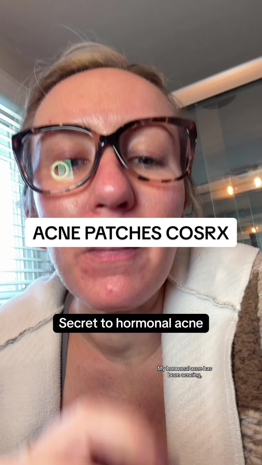 TikTok post by @tamie.konzier for COSRX. Caption reads: Thank you @COSRX US for the best acne patches!....
