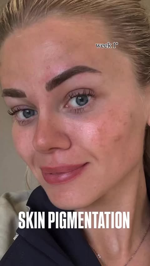 Instagram post by @katedelamere for Dermatica. Caption reads: [...] start yours today KATIE20 for 20% off....