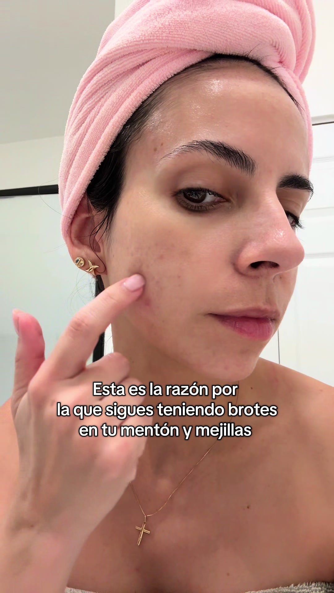 TikTok post by @isabustillos for CLEARSTEM Skincare. Caption reads: [...] #acnehormonal #dim #clearsteam @CLEARSTEM....