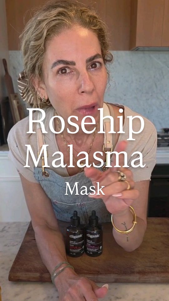 Instagram post by @dewyfacedbitch for Cliganic. Caption reads: HYPERPIGMENTATION and MALASMA! You guys are always....